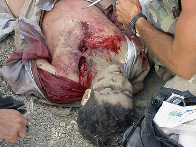 Two soldiers kneel over the wounded Khadr. Two soldiers kneel over the wounded Khadr.